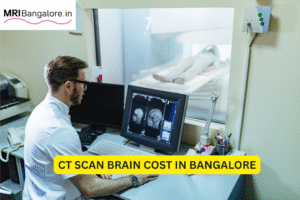 CT SCAN BRAIN COST IN BANGALORE