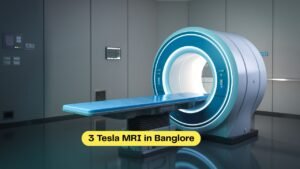 3 Tesla MRI in Banglore