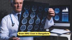 Brain MRI Cost in Bangalore