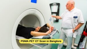 PSMA PET CT Scan in Banglore